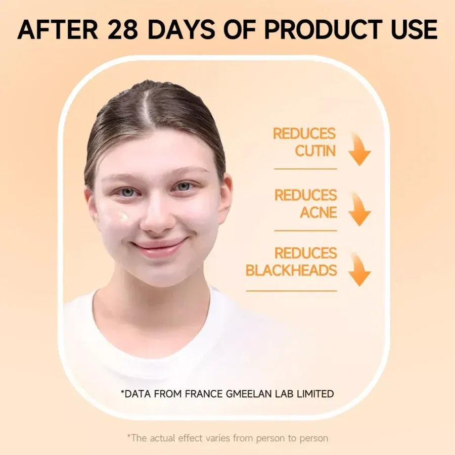 Orange Enzyme Glow Gel š Dark Spot & Dead Skin Remover